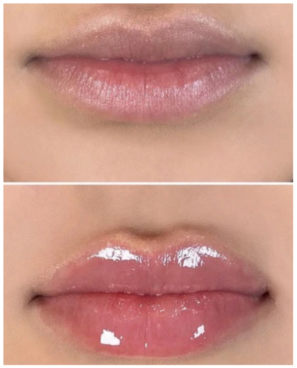 BIMBO - Instant Lip Filler